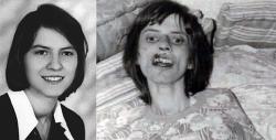 The real Anneliese Michel/The Exorcism of Emily Rose